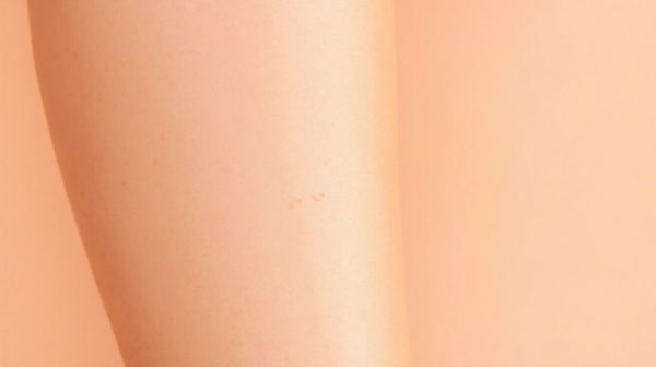 Découvrez My Lazer : épilation laser sur mesure pour tous types de peau